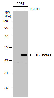 Non-transfected (�) and transfected (+) 293T whole cell extracts (30 ug) were separated by 10% SDS-PAGE,and the membrane was blotted with TGF beta 1 antibody (GTX45121) diluted at 1:5000.