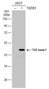 Non-transfected (-) and transfected (+) 293T whole cell extracts (30 microg) were separated by 10% SDS-PAGE, and the membrane was blotted with TGF beta 1 antibody (GTX45121) diluted at 1:5000. The HRP-conjugated anti-rabbit IgG antibody (GTX213110-01) was used to detect the primary antibody.
