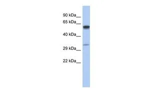 WB analysis of human fetal small intestine tissue using GTX45140 ZDHHC24 antibody at 0.2-1microg/ml. WB analysis of human fetal small intestine tissue using GTX45140 ZDHHC24 antibody at 0.2-1microg/ml.