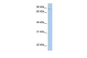 WB analysis of human fetal kidney tissue using GTX45158 LRRC33 antibody at 0.2-1microg/ml. WB analysis of human fetal kidney tissue using GTX45158 LRRC33 antibody at 0.2-1microg/ml.