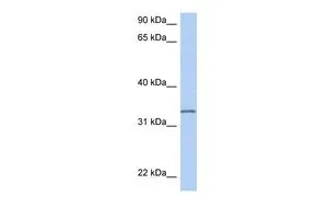 WB analysis of MCF-7 cells using GTX45161 C3ORF62 antibody at 0.2-1microg/ml. WB analysis of MCF-7 cells using GTX45161 C3ORF62 antibody at 0.2-1microg/ml.