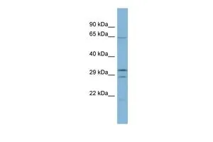 WB analysis of human B lymphoblast cells using GTX45181 FAM131C antibody at 0.2-1microg/ml. WB analysis of human B lymphoblast cells using GTX45181 FAM131C antibody at 0.2-1microg/ml.