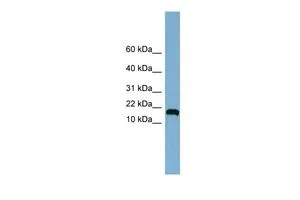 WB analysis of Jurkat cells using GTX45188 ANKRD37 antibody at 0.2-1microg/ml. WB analysis of Jurkat cells using GTX45188 ANKRD37 antibody at 0.2-1microg/ml.