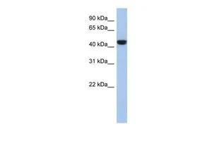 WB analysis of human B lymphoblast cells using GTX45199 C2ORF53 antibody at 0.2-1microg/ml. WB analysis of human B lymphoblast cells using GTX45199 C2ORF53 antibody at 0.2-1microg/ml.