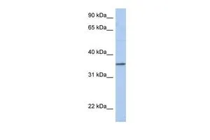 WB analysis of human fetal small intestine tissue using GTX45208 PRR18 antibody at 0.2-1microg/ml. WB analysis of human fetal small intestine tissue using GTX45208 PRR18 antibody at 0.2-1microg/ml.