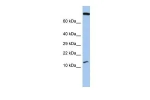 WB analysis of human fetal stomach tissue using GTX45224 FLJ37543 antibody at 0.2-1microg/ml. WB analysis of human fetal stomach tissue using GTX45224 FLJ37543 antibody at 0.2-1microg/ml.