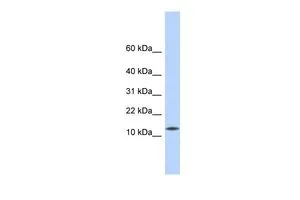 WB analysis of human fetal heart tissue using GTX45229 CDRT4 antibody at 0.2-1microg/ml. WB analysis of human fetal heart tissue using GTX45229 CDRT4 antibody at 0.2-1microg/ml.