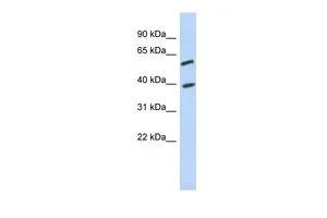 WB analysis of Jurkat cells using GTX45235 C6ORF146 antibody at 0.2-1microg/ml. WB analysis of Jurkat cells using GTX45235 C6ORF146 antibody at 0.2-1microg/ml.