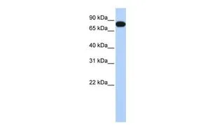 WB analysis of human placenta tissue using GTX45249 Eml.3 antibody at 0.2-1microg/ml. WB analysis of human placenta tissue using GTX45249 Eml.3 antibody at 0.2-1microg/ml.