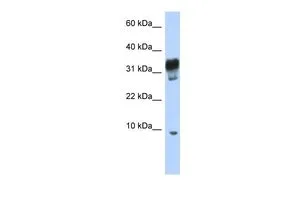 WB analysis of Jurkat cells using GTX45253 PXT1 antibody at 0.2-1microg/ml. WB analysis of Jurkat cells using GTX45253 PXT1 antibody at 0.2-1microg/ml.
