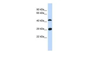 WB analysis of human fetal muscle tissue using GTX45258 C4ORF22 antibody at 0.2-1microg/ml. WB analysis of human fetal muscle tissue using GTX45258 C4ORF22 antibody at 0.2-1microg/ml.