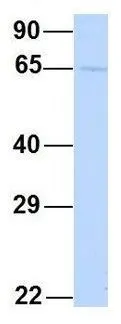 WB analysis of human B lymphoblast cells using GTX45260 YTHDF3 antibody at 1microg/ml.