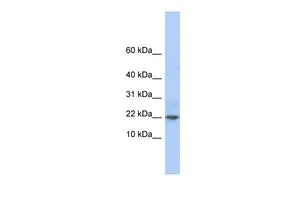 WB analysis of Jurkat cells using GTX45271 C9ORF25 antibody at 0.2-1ug/ml.