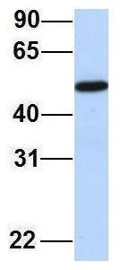 WB analysis of MCF-7 cells using GTX45308 FAM98A antibody at 1microg/ml.