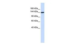 WB analysis of 293T cells using GTX45331 DAAM1 antibody at 0.2-1microg/ml. WB analysis of 293T cells using GTX45331 DAAM1 antibody at 0.2-1microg/ml.