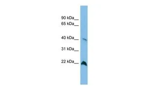 WB analysis of A549 cells using GTX45345 TGDS antibody at 0.2-1microg/ml. WB analysis of A549 cells using GTX45345 TGDS antibody at 0.2-1microg/ml.