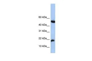 WB analysis of HepG2 cells using GTX45407 LOC285033 antibody at 0.2-1microg/ml. WB analysis of HepG2 cells using GTX45407 LOC285033 antibody at 0.2-1microg/ml.