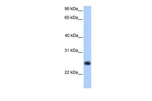 WB analysis of human fetal muscle tissue using GTX45421 C12orf68 antibody at 0.2-1microg/ml. WB analysis of human fetal muscle tissue using GTX45421 C12orf68 antibody at 0.2-1microg/ml.