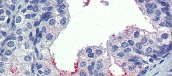 IHC-P analysis of human prostate tissue using GTX45442 AMH antibody at 5.0microg/ml. IHC-P analysis of human prostate tissue using GTX45442 AMH antibody at 5.0microg/ml.