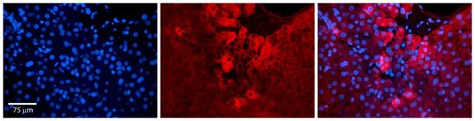 IHC-P analysis of human liver tissue using GTX45443 ZC3H14 antibody at 1:100. Left to right:DAPI, ZC3H14, Merge. Low pH, heat-induced antigen retrieval method utilizing Sodium Citrate buffer. IHC-P analysis of human liver tissue using GTX45443 ZC3H14 antibody at 1:100. Left to right:DAPI, ZC3H14, Merge. Low pH, heat-induced antigen retrieval method utilizing Sodium Citrate buffer.