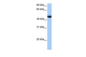 WB analysis of human muscle tissue using GTX45449 PAOX antibody at 0.2-1microg/ml. WB analysis of human muscle tissue using GTX45449 PAOX antibody at 0.2-1microg/ml.