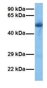 WB analysis of human lung tumor tissue using GTX45449 PAOX antibody at 1.0microg/ml.