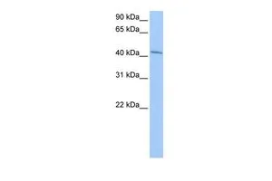 WB analysis of NTERA2 cells using GTX45454 GSG1 antibody at 0.2-1microg/ml. WB analysis of NTERA2 cells using GTX45454 GSG1 antibody at 0.2-1microg/ml.