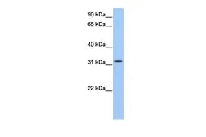 WB analysis of human B lymphoblast cells using GTX45460 C14ORF140 antibody at 0.2-1microg/ml. WB analysis of human B lymphoblast cells using GTX45460 C14ORF140 antibody at 0.2-1microg/ml.