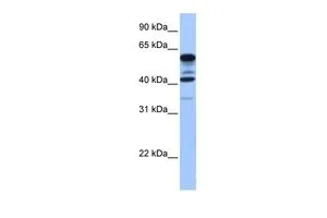 WB analysis of human heart tissue using GTX45471 FAM46C antibody at 0.2-1microg/ml. WB analysis of human heart tissue using GTX45471 FAM46C antibody at 0.2-1microg/ml.