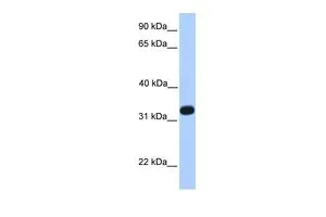 WB analysis of human fetal liver tissue using GTX45490 ACRV1 antibody at 0.2-1microg/ml. WB analysis of human fetal liver tissue using GTX45490 ACRV1 antibody at 0.2-1microg/ml.