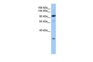 WB analysis of human fetal brain tissue using GTX45495 AP2B1 antibody at 0.2-1microg/ml. WB analysis of human fetal brain tissue using GTX45495 AP2B1 antibody at 0.2-1microg/ml.