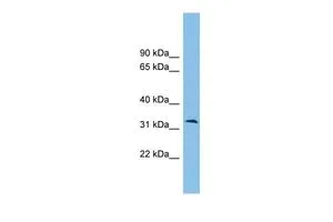 WB analysis of HeLa cells using GTX45518 ZPBP2 antibody at 0.2-1microg/ml. WB analysis of HeLa cells using GTX45518 ZPBP2 antibody at 0.2-1microg/ml.
