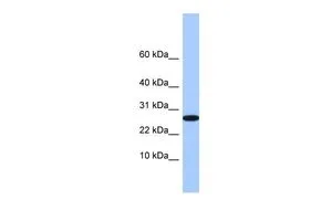 WB analysis of human B lymphoblast cells using GTX45535 FAM101A antibody at 0.2-1microg/ml. WB analysis of human B lymphoblast cells using GTX45535 FAM101A antibody at 0.2-1microg/ml.