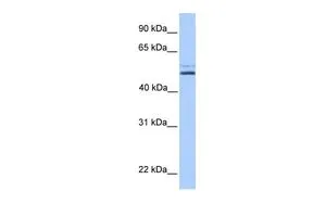 WB analysis of NTERA2 cells using GTX45540 NHEDC2 antibody at 0.2-1microg/ml. WB analysis of NTERA2 cells using GTX45540 NHEDC2 antibody at 0.2-1microg/ml.