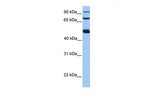 WB analysis of HeLa cells using GTX45542 WDR49 antibody at 0.2-1microg/ml. WB analysis of HeLa cells using GTX45542 WDR49 antibody at 0.2-1microg/ml.