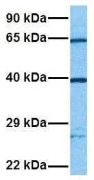 WB analysis of Jurkat cells using GTX45550 2-PDE antibody at 1.0microg/ml.