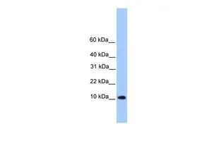 WB analysis of HeLa cells using GTX45551 TRAPPC6B antibody at 0.2-1microg/ml. WB analysis of HeLa cells using GTX45551 TRAPPC6B antibody at 0.2-1microg/ml.