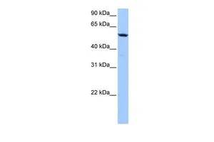 WB analysis of HeLa cells using GTX45571 C18ORF54 antibody at 0.2-1microg/ml. WB analysis of HeLa cells using GTX45571 C18ORF54 antibody at 0.2-1microg/ml.
