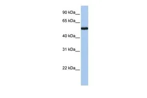 WB analysis of Jurkat cells using GTX45575 FLJ90709 antibody at 0.2-1microg/ml. WB analysis of Jurkat cells using GTX45575 FLJ90709 antibody at 0.2-1microg/ml.