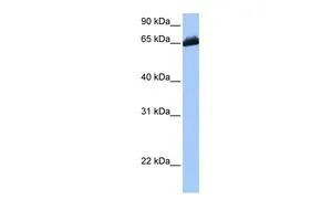 WB analysis of HepG2 cells using GTX45579 C19ORF21 antibody at 0.2-1microg/ml. WB analysis of HepG2 cells using GTX45579 C19ORF21 antibody at 0.2-1microg/ml.