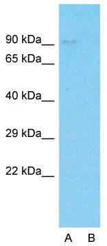 WB analysis of HeLa cells using GTX45579 C19ORF21 antibody at 5microg/ml. Lane A: Primary antibody Lane B: Primary antibody + blocking peptide