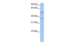 WB analysis of HepG2 cells using GTX45581 CCDC78 antibody at 0.2-1microg/ml. WB analysis of HepG2 cells using GTX45581 CCDC78 antibody at 0.2-1microg/ml.