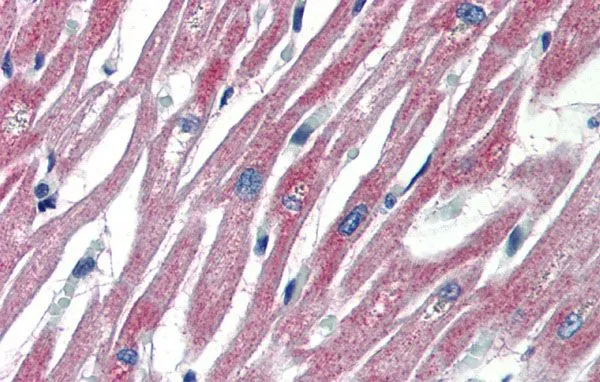 IHC-P analysis of human heart tissue using GTX45588 PLEKHH2 antibody at 10microg/ml. IHC-P analysis of human heart tissue using GTX45588 PLEKHH2 antibody at 10microg/ml.