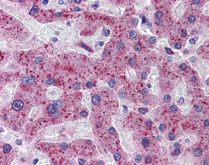 IHC-P analysis of human liver tissue using GTX45599 TMPRSS6 antibody at 5microg/ml. IHC-P analysis of human liver tissue using GTX45599 TMPRSS6 antibody at 5microg/ml.