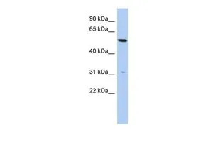 WB analysis of HepG2 cells using GTX45605 TMEM161B antibody at 0.2-1microg/ml. WB analysis of HepG2 cells using GTX45605 TMEM161B antibody at 0.2-1microg/ml.
