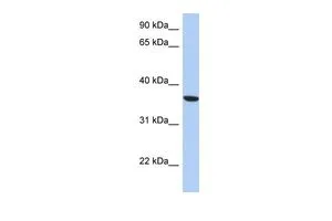 WB analysis of THP-1 cells using GTX45610 PSTK antibody at 0.2-1microg/ml. WB analysis of THP-1 cells using GTX45610 PSTK antibody at 0.2-1microg/ml.