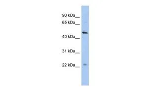 WB analysis of HepG2 cells using GTX45641 C12ORF50 antibody at 0.2-1microg/ml. WB analysis of HepG2 cells using GTX45641 C12ORF50 antibody at 0.2-1microg/ml.