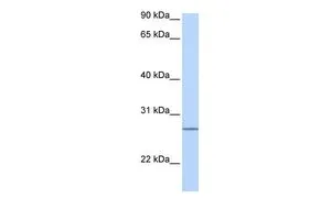 WB analysis of human fetal heart tissue using GTX45661 GRPEL2 antibody at 0.2-1microg/ml. WB analysis of human fetal heart tissue using GTX45661 GRPEL2 antibody at 0.2-1microg/ml.