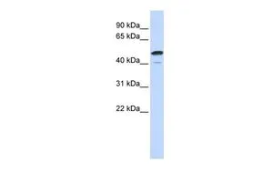 WB analysis of human brain tissue using GTX45672 SPATA2L antibody at 0.2-1microg/ml. WB analysis of human brain tissue using GTX45672 SPATA2L antibody at 0.2-1microg/ml.