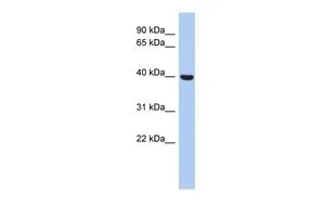 WB analysis of human B lymphoblast cells using GTX45686 STOml.3 antibody at 0.2-1microg/ml. WB analysis of human B lymphoblast cells using GTX45686 STOml.3 antibody at 0.2-1microg/ml.